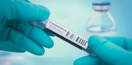 Coronavirus myths Detail of coronavirus test sample