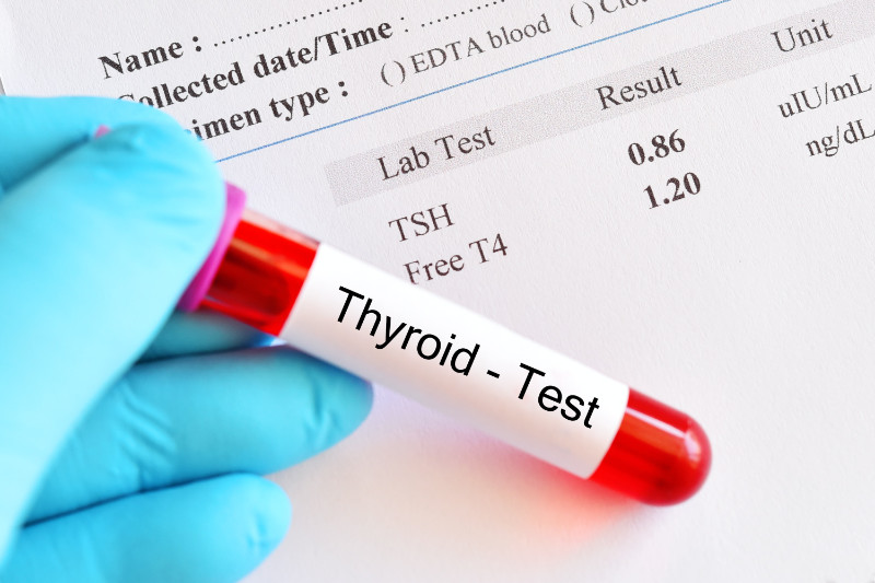 Thyroid disorders test