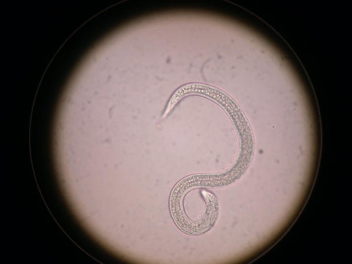 A microscopic view of a nematode.
