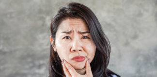 Asian woman having problem with Bell's Palsy