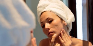 What causes adult acne