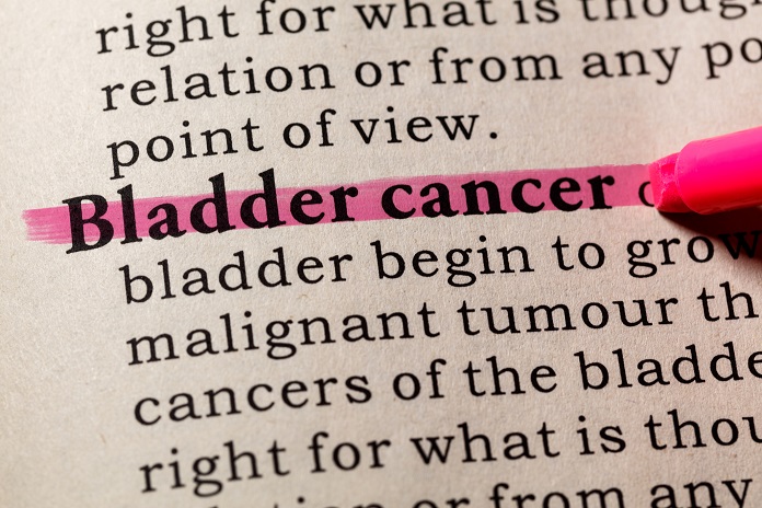 bladder cancer the silent killer
