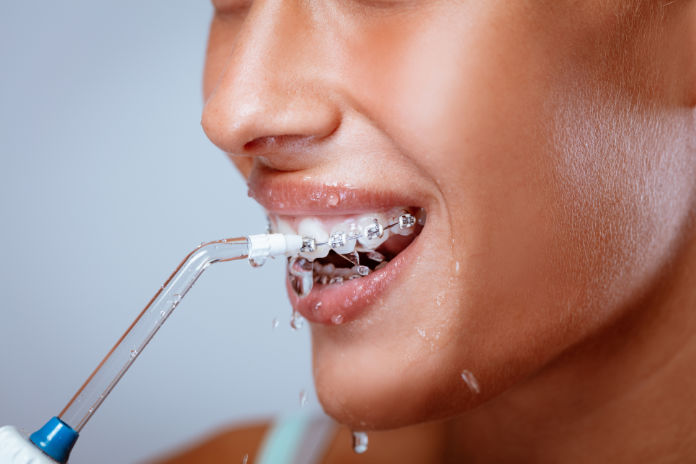 Close-up of a smiling woman face with braces cleaning her teeth with oral irrigator.