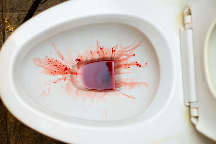 Urine is red blood urine in flush tank in the bathroom,
