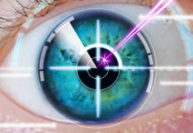 eye laser correction